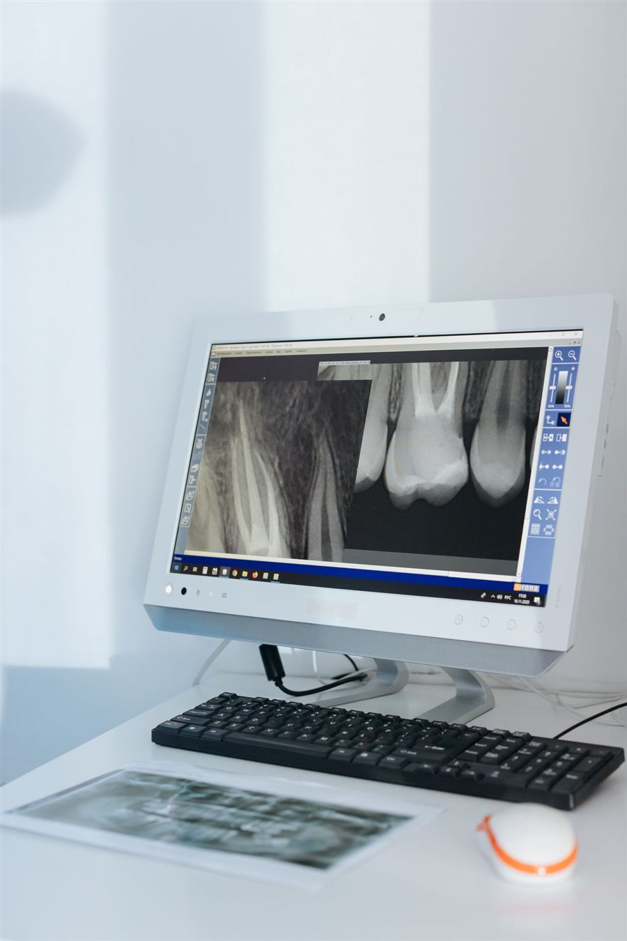 Radiografia periapical digital em tela de computador